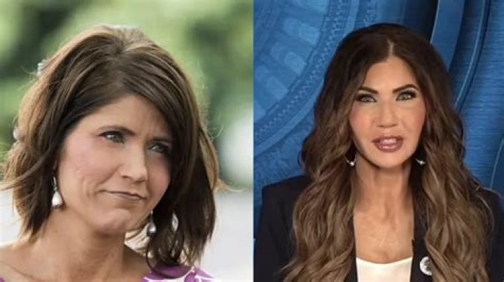 Has Kristen Wiig Had Plastic Surgery? She Looks Different in Her Before and After Pictures